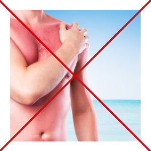 Sunburn! When it’s too late for sun protection, Aloe Vera can help.